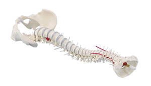 anatomisches Modell, Wirbelsule mit Bandscheibenvorfall und Becken, ohne Stativ