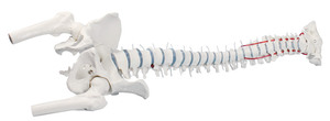 anatomisches Modell, Wirbelsule mit Bandscheibenvorfall, Becken und Oberschenkelstmpfen, ohne Stativ