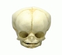 Fetussch�del, 35 Wochen 
