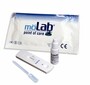 m�Lab Syphilis Test z qual. Nachweis von Syphilisspezifischen Antik�rpern 25 Test 