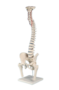 anatomisches Modell, Wirbelsule mit Bandscheibenvorfall, Becken, Oberschenkelstmpfen und Stativ 