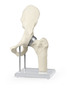 H�ftmodell mit Schalenprothese