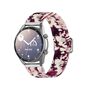 Smartwatch Armband Armb�nder 20 mm f�r Samsung Galaxy LG Watch Honor Garmin