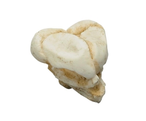 Fetusschdel, 13 Wochen