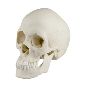 Skaphozephaler Sch�del