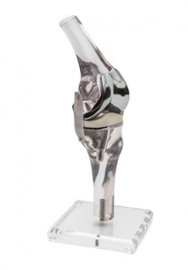 Knie, Kniegelenk, Gelenk, anatomisches Modell, Kniegelenk mit Endoprothese
