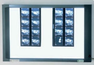 Rntgenfilmbetrachter 742x442 cm Betrachtungsflche TFT LCD Backlight Technologie