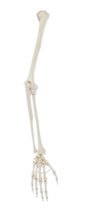 Armskelett, Arm Skelett, Naturgetreuer Abguss, Pro- und Supination demonstrierbar