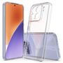 F�r Xiaomi 15 Schutz Cover H�lle Case Tasche Etuis TPU Hart Glas Folie AUSWAHL