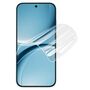 Hydrogel f�r Xiaomi Poco X8 Pro 5G / Redmi Turbo 5 5G Full Screen