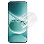 Hydrogel f�r Xiaomi Redmi Note 15 Pro 4G Full Cover Schutz Kratzfest